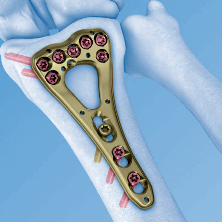 Khám Phá Thế Giới Đặt Cược Thú Vị Với bet66 - Trải Nghiệm Đỉnh Cao Cùng Nền Tảng Đẳng Cấp